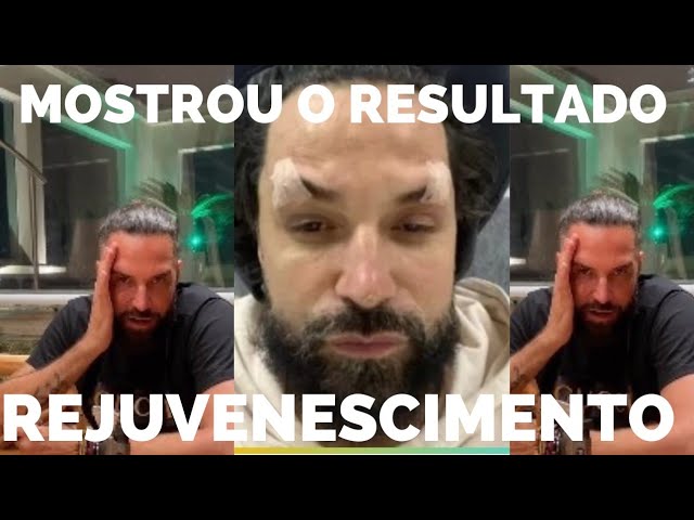 LATINO MOSTRA O RESULTADO DO SEU REJUVENESCIMENTO APÓS SER CRITICADO PELA SUA APARÊNCIA!!#LATINO